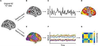 Functional Connectivity in Multiple Sclerosis: Recent Findings and Future Directions